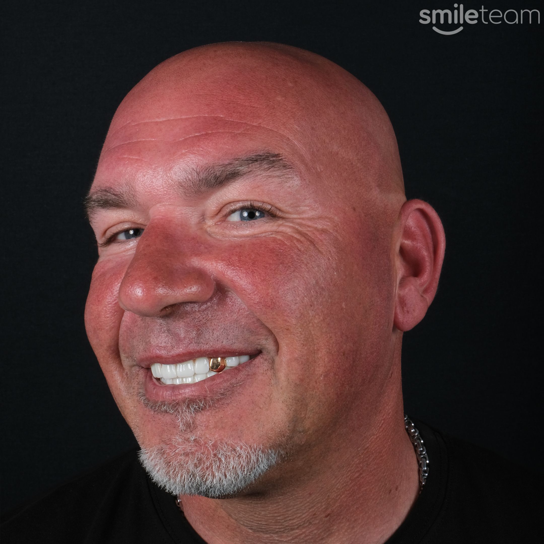 Smile result